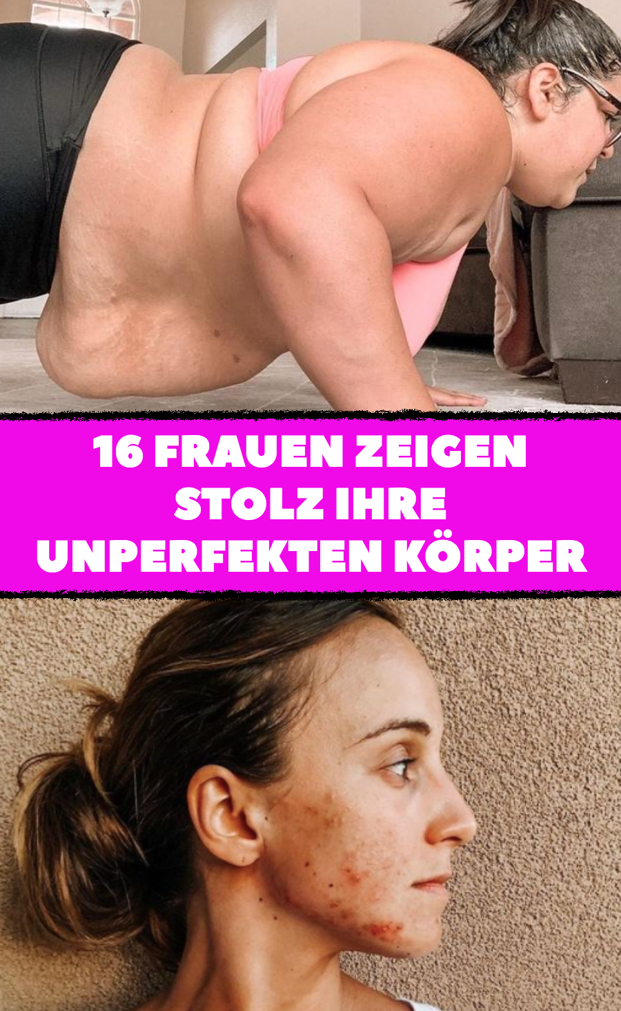 Nicht perfekt: Diese Frauen sind stolz auf ihren Körper