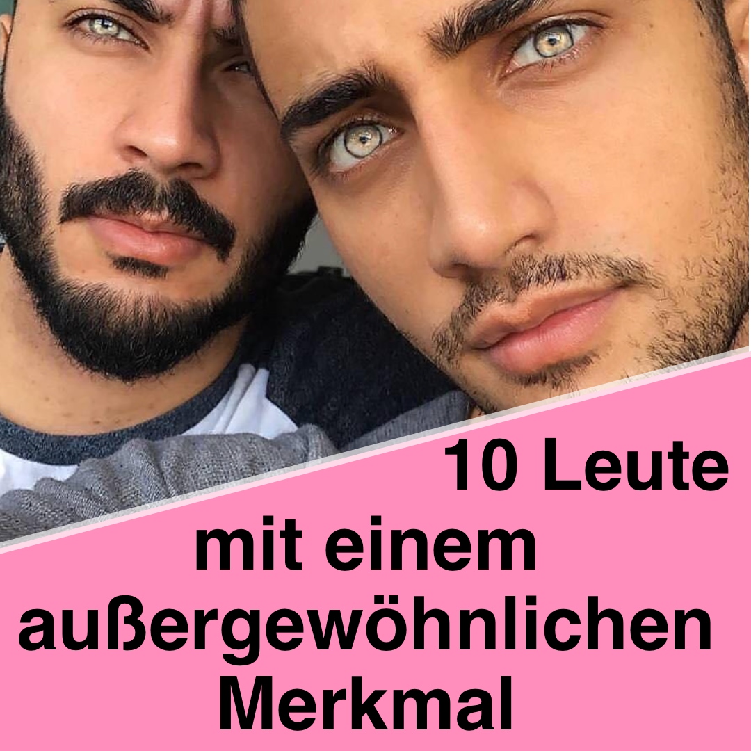 10 Leute mit einem außergewöhnlichen Merkmal