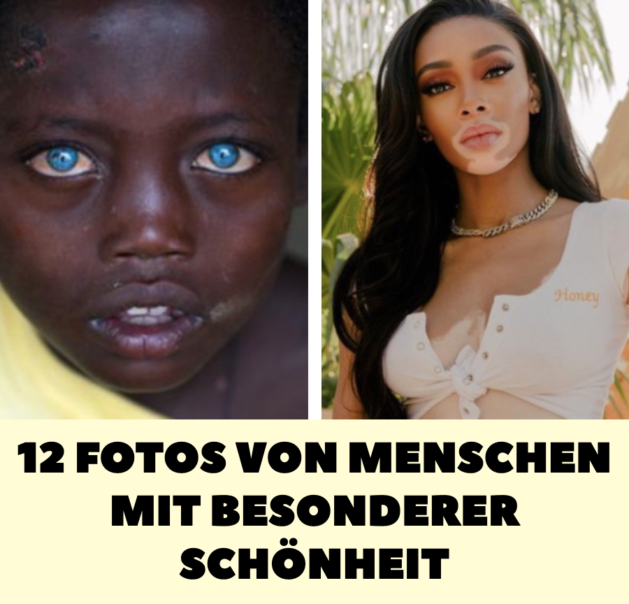 12 Fotos von Menschen mit besonderer Schönheit